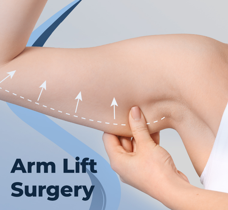 Arm Lift Surgery